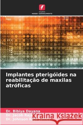Implantes pterigóides na reabilitação de maxilas atróficas Dayana, Dr. Bibiya, Raja, Dr. Jacob, Raja James, Dr. Johnson 9786209099571