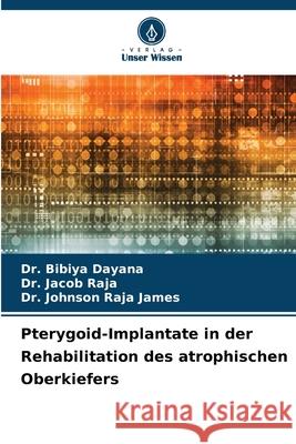 Pterygoid-Implantate in der Rehabilitation des atrophischen Oberkiefers Dayana, Dr. Bibiya, Raja, Dr. Jacob, Raja James, Dr. Johnson 9786209102134
