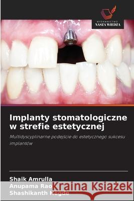 Implanty stomatologiczne w strefie estetycznej Amrulla, Shaik, Rao, Anupama, Hegde, Shashikanth 9786209107559