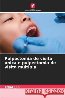 Pulpectomia de visita única e pulpectomia de visita múltipla J.S, ANJALI 9786209108426