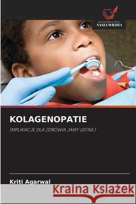 KOLAGENOPATIE Agarwal, Kriti 9786209109249