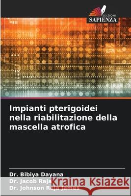Impianti pterigoidei nella riabilitazione della mascella atrofica Dayana, Dr. Bibiya, Raja, Dr. Jacob, Raja James, Dr. Johnson 9786209109829
