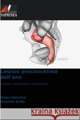Lesioni precancerose dell'ano Hassine, Hajer, Krifa, Nesrine 9786209121234 Edizioni Sapienza