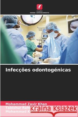 Infecções odontogénicas Khan, Mohammad Zavir, Rahman, Tabishur, Ansari, Mohammad Kalim 9786209121654