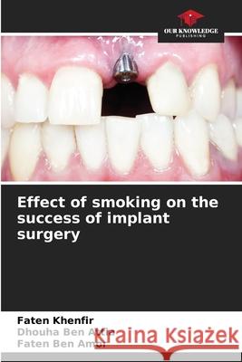 Effect of smoking on the success of implant surgery Khenfir, Faten, Ben Attia, Dhouha, Ben Amor, Faten 9786209123207 Our Knowledge Publishing
