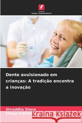 Dente avulsionado em crianças: A tradição encontra a inovação Shere, Shraddha, Chhabra, Chaya 9786209127205