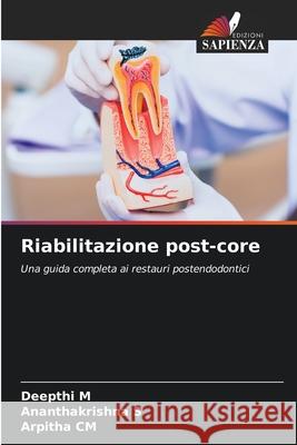 Riabilitazione post-core M, Deepthi, S, Ananthakrishna, CM, Arpitha 9786209128714