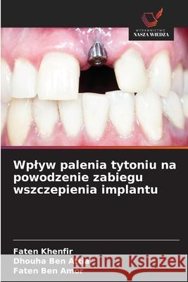 Wplyw palenia tytoniu na powodzenie zabiegu wszczepienia implantu Khenfir, Faten, Ben Attia, Dhouha, Ben Amor, Faten 9786209133442 Wydawnictwo Nasza Wiedza