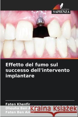 Effetto del fumo sul successo dell'intervento implantare Khenfir, Faten, Ben Attia, Dhouha, Ben Amor, Faten 9786209136009 Edizioni Sapienza