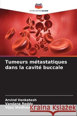 Tumeurs métastatiques dans la cavité buccale Venkatesh, Arvind, Reddy, Vandana, Wadhwan, Vijay 9786209140914