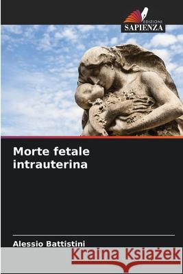 Morte fetale intrauterina Battistini, Alessio 9786209144288