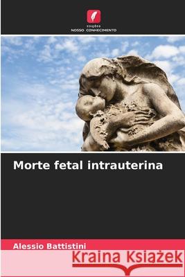 Morte fetal intrauterina Battistini, Alessio 9786209146848