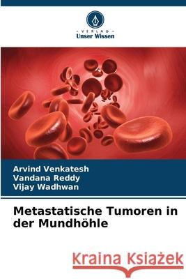 Metastatische Tumoren in der Mundhöhle Venkatesh, Arvind, Reddy, Vandana, Wadhwan, Vijay 9786209166525