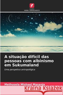 A situa??o dif?cil das pessoas com albinismo em Sukumaland Methusela Mishael Masanja 9786209204456