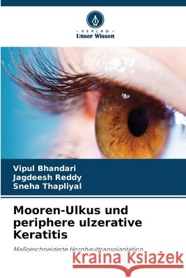 Mooren-Ulkus und periphere ulzerative Keratitis Bhandari, Vipul, Reddy, Jagdeesh, Thapliyal, Sneha 9786209215476