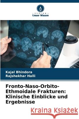 Fronto-Naso-Orbito-Ethmoidale Frakturen: Klinische Einblicke und Ergebnisse Kajal Bhindora Rajshekhar Halli 9786209221569