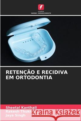 Reten??o E Recidiva Em Ortodontia Sheetal Kanthali Rakesh Thukral Jaya Singh 9786209225147 Edicoes Nosso Conhecimento