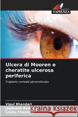 Ulcera di Mooren e cheratite ulcerosa periferica Bhandari, Vipul, Reddy, Jagdeesh, Thapliyal, Sneha 9786209225710