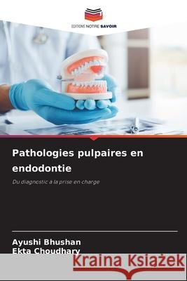 Pathologies pulpaires en endodontie Ayushi Bhushan Ekta Choudhary 9786209229305