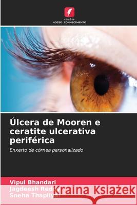 Úlcera de Mooren e ceratite ulcerativa periférica Bhandari, Vipul, Reddy, Jagdeesh, Thapliyal, Sneha 9786209233395