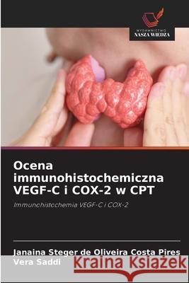 Ocena immunohistochemiczna VEGF-C i COX-2 w CPT Steger de Oliveira Costa Pires, Janaina, Saddi, Vera 9786209239601