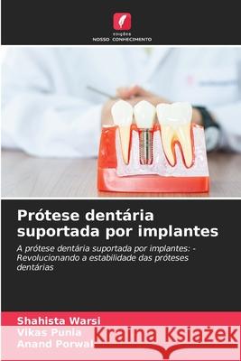 Pr?tese dent?ria suportada por implantes Shahista Warsi Vikas Punia Anand Porwal 9786209243066 Edicoes Nosso Conhecimento