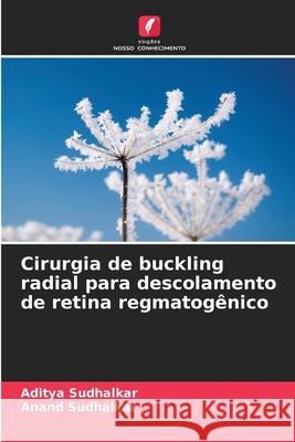 Cirurgia de buckling radial para descolamento de retina regmatog?nico Aditya Sudhalkar Anand Sudhalkar 9786209254147