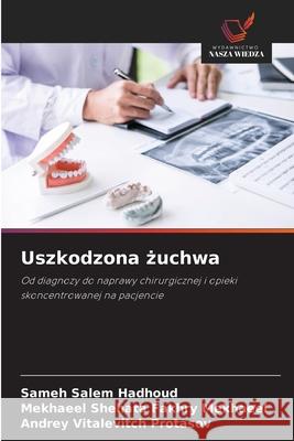 Uszkodzona zuchwa Hadhoud, Sameh Salem, Mekhaeel, Mekhaeel Shehata Fakhry, Protasov, Andrey Vitalevitch 9786209254642 Wydawnictwo Nasza Wiedza