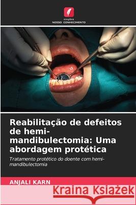 Reabilitação de defeitos de hemi-mandibulectomia: Uma abordagem protética KARN, ANJALI 9786209254796