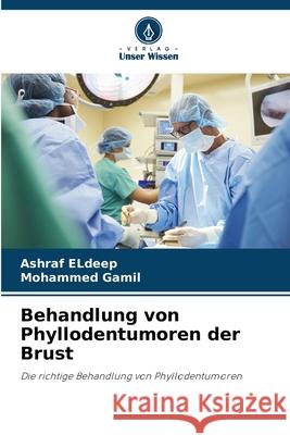 Behandlung von Phyllodentumoren der Brust Eldeep, Ashraf, Gamil, Mohammed 9786209264856 Verlag Unser Wissen