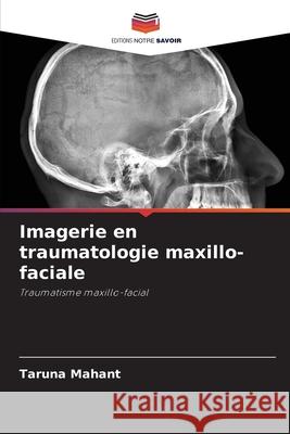 Imagerie en traumatologie maxillo-faciale Mahant, Taruna 9786209269219