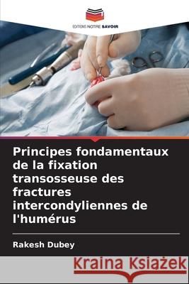 Principes fondamentaux de la fixation transosseuse des fractures intercondyliennes de l'humérus Dubey, Rakesh 9786209272325 Editions Notre Savoir