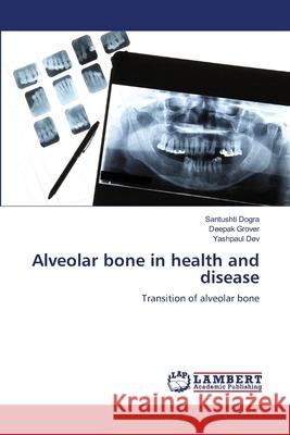Alveolar bone in health and disease Dogra, Santushti, Grover, Deepak, Dev, Yashpaul 9786209278976