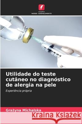 Utilidade do teste cutâneo no diagnóstico de alergia na pele Michalska, Grazyna 9786209280290