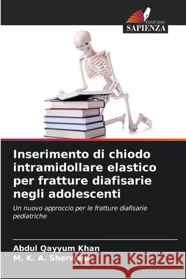 Inserimento di chiodo intramidollare elastico per fratture diafisarie negli adolescenti Khan, Abdul Qayyum, Sherwani, M. K. A. 9786209284458