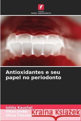 Antioxidantes e seu papel no periodonto Kaushal, Ishita, Jindal, Vikas, Chauhan, Shiva 9786209285950