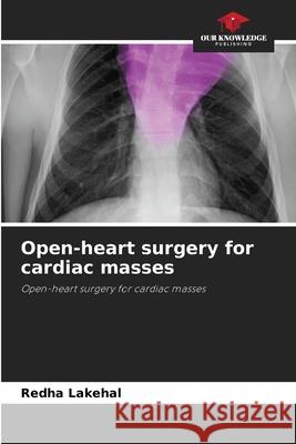 Open-heart surgery for cardiac masses Lakehal, Redha 9786209289279