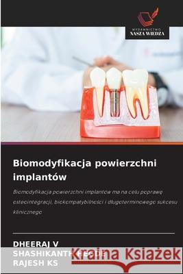 Biomodyfikacja powierzchni implantów V, DHEERAJ, Hegde, Shashikanth, KS, RAJESH 9786209289415