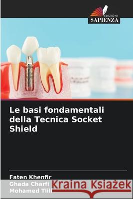 Le basi fondamentali della Tecnica Socket Shield Khenfir, Faten, Charfi, Ghada, Tlili, Mohamed 9786209290442 Edizioni Sapienza