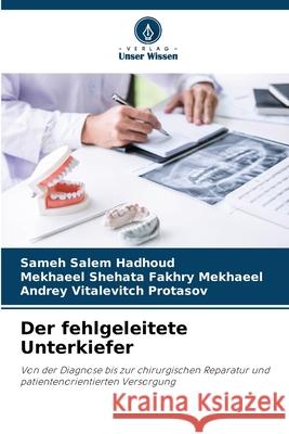 Der fehlgeleitete Unterkiefer Hadhoud, Sameh Salem, Mekhaeel, Mekhaeel Shehata Fakhry, Protasov, Andrey Vitalevitch 9786209293030 Verlag Unser Wissen