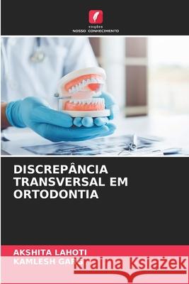 DISCREPÂNCIA TRANSVERSAL EM ORTODONTIA LAHOTI, AKSHITA, GARG, KAMLESH 9786209294815 Edições Nosso Conhecimento