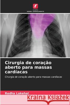 Cirurgia de coração aberto para massas cardíacas Lakehal, Redha 9786209296956