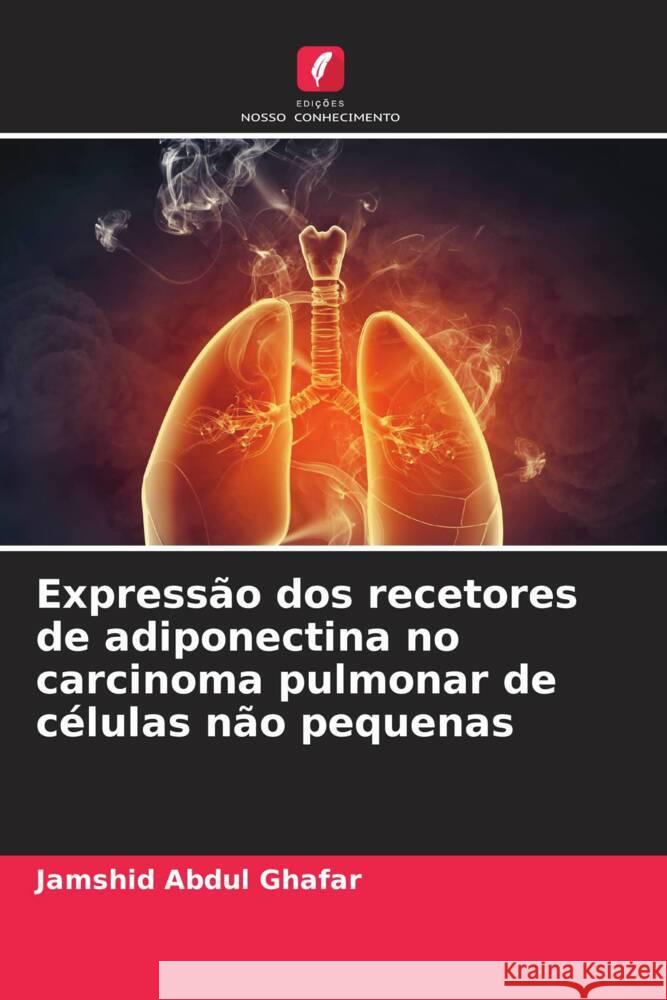 Expressão dos recetores de adiponectina no carcinoma pulmonar de células não pequenas Abdul Ghafar, Jamshid 9786209307454