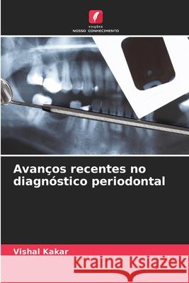 Avanços recentes no diagnóstico periodontal Kakar, Vishal 9786209307553