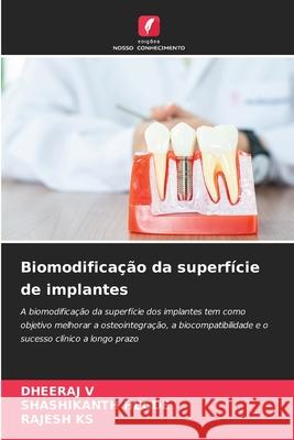 Biomodificação da superfície de implantes V, DHEERAJ, Hegde, Shashikanth, KS, RAJESH 9786209307690