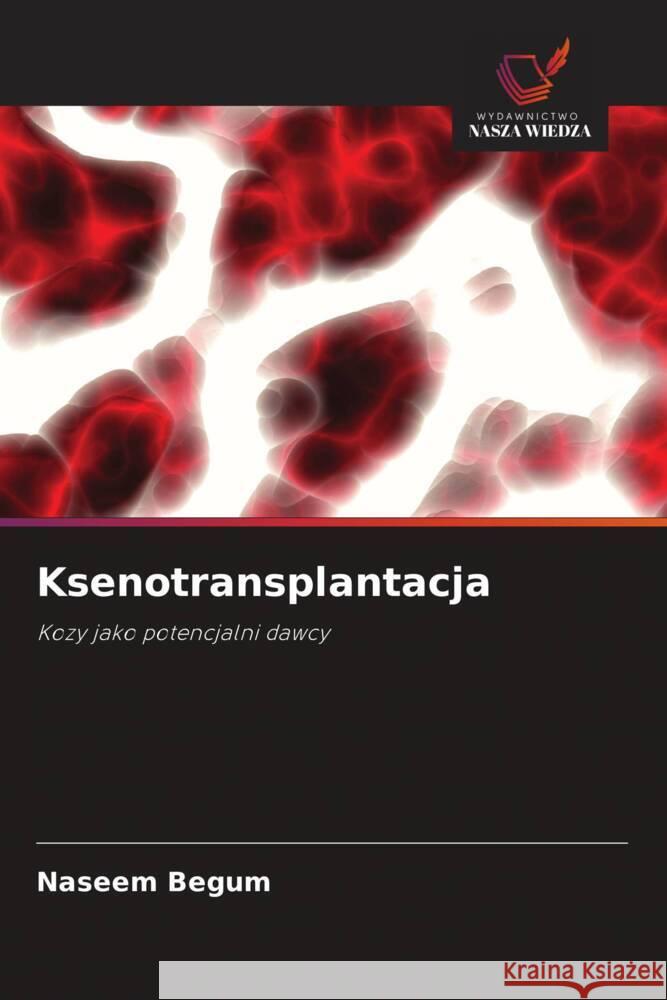 Ksenotransplantacja Begum, Naseem 9786209310386 Wydawnictwo Nasza Wiedza