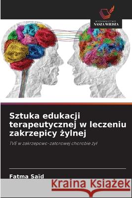 Sztuka edukacji terapeutycznej w leczeniu zakrzepicy zylnej Saïd, Fatma 9786209314650