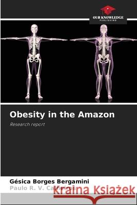 Obesity in the Amazon Bergamini, Gésica Borges, Calheiros, Paulo R. V. 9786209316227 Our Knowledge Publishing