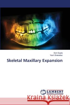 Skeletal Maxillary Expansion Soni Gupta Yash Shekatkar 9786209317859