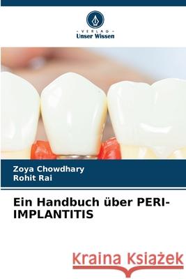 Ein Handbuch über PERI-IMPLANTITIS Chowdhary, Zoya, Rai, Rohit 9786209325724